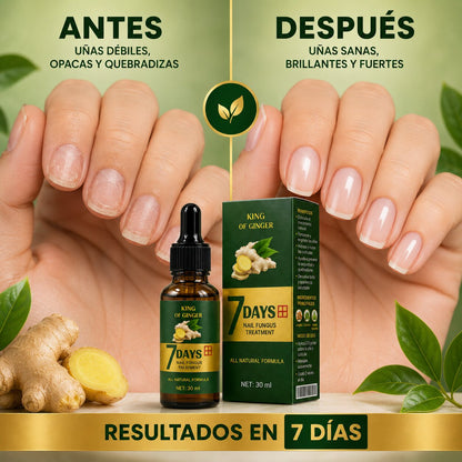 🌿 El aceite de jengibre que fortalece la uña y acelera su crecimiento desde la raíz.